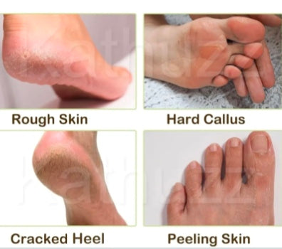 Silicone Gel Spa Socks.(Pack of 1)
